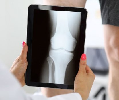 Is-Joint-replacement-permanent